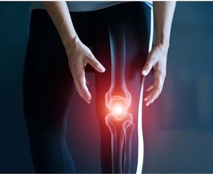 退化性關節炎,osteoarthritis