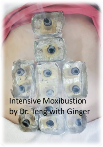 Intensive Moxibustion by Dr Teng with Ginger.